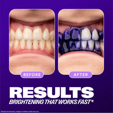 HI SMILE TEETH BRIGHTENING