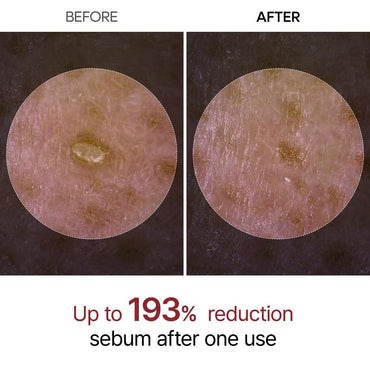 DR.MELAXIN PEEL SHOT EXFOLIATING BLACK RICE AMPOULE (FOR ALL SKIN TYPE)