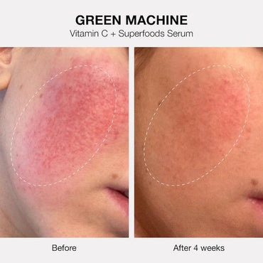 Innbeauty Project The Healthy Skin Edit Bestsellers Kit