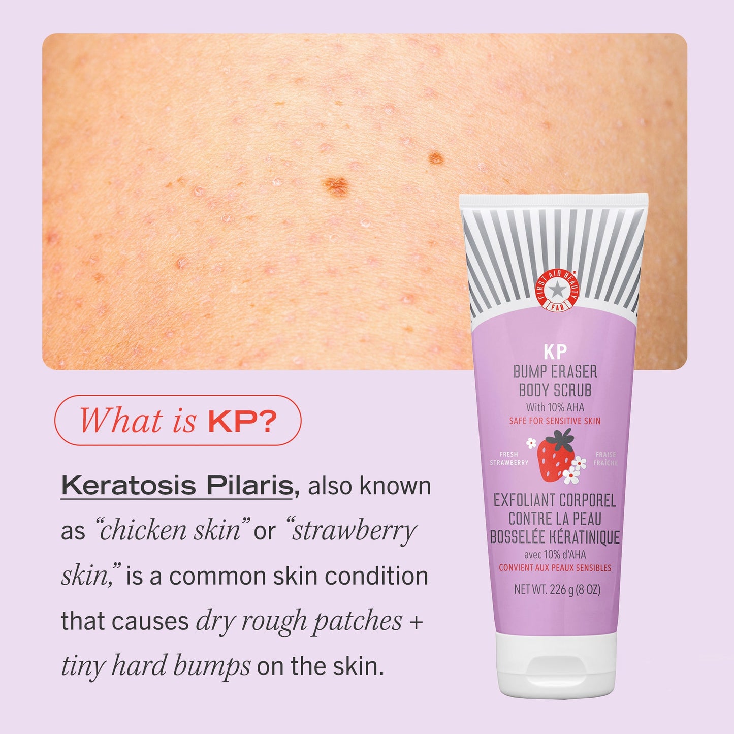 FIRST AID BEAUTY BUMP ERASER BODY SCRUB