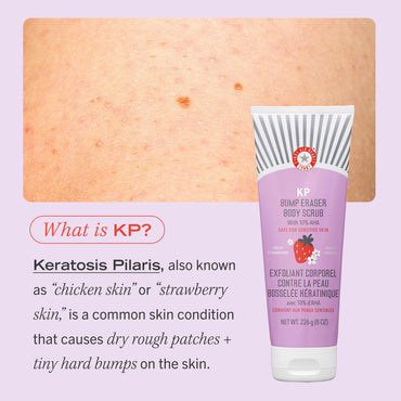 FIRST AID BEAUTY BUMP ERASER BODY SCRUB