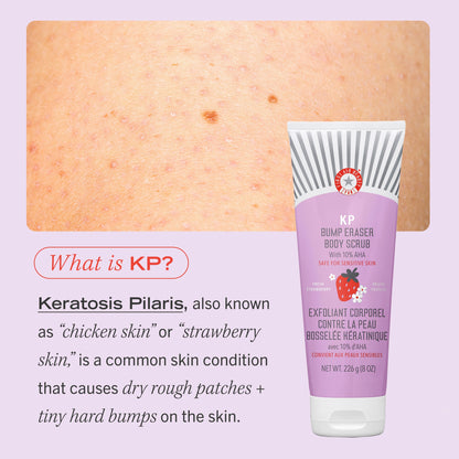 FIRST AID BEAUTY BUMP ERASER BODY SCRUB