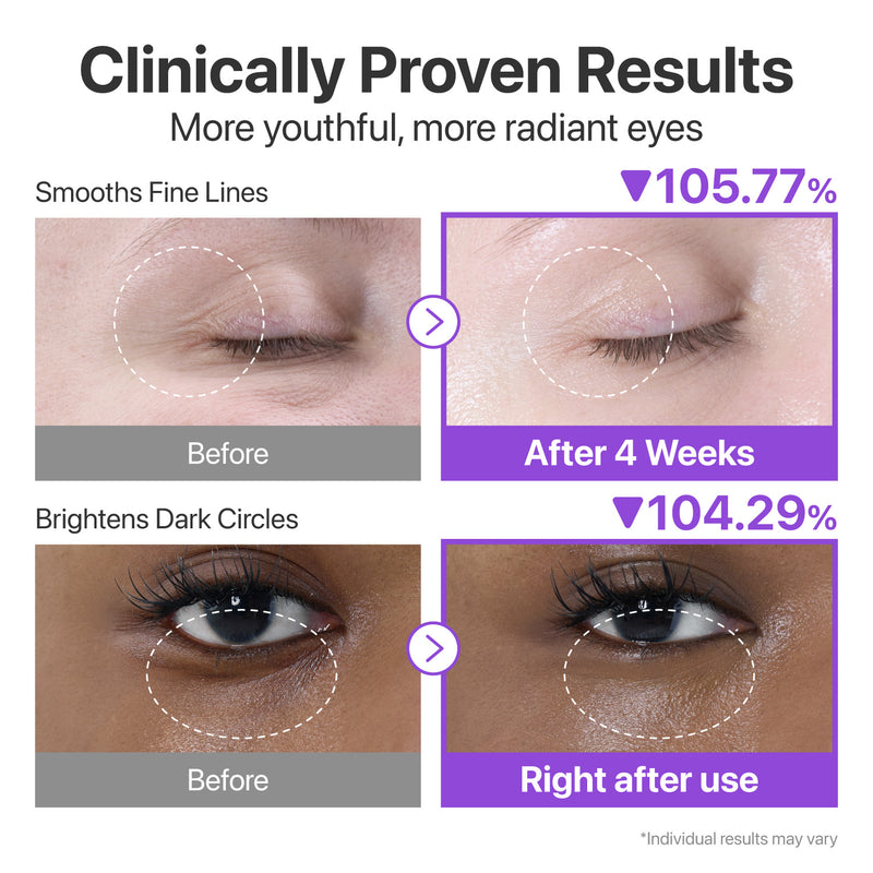 NUMBUZIN NMN RETINOL NMN + RETINOL VILUMTEX EYE CREAM