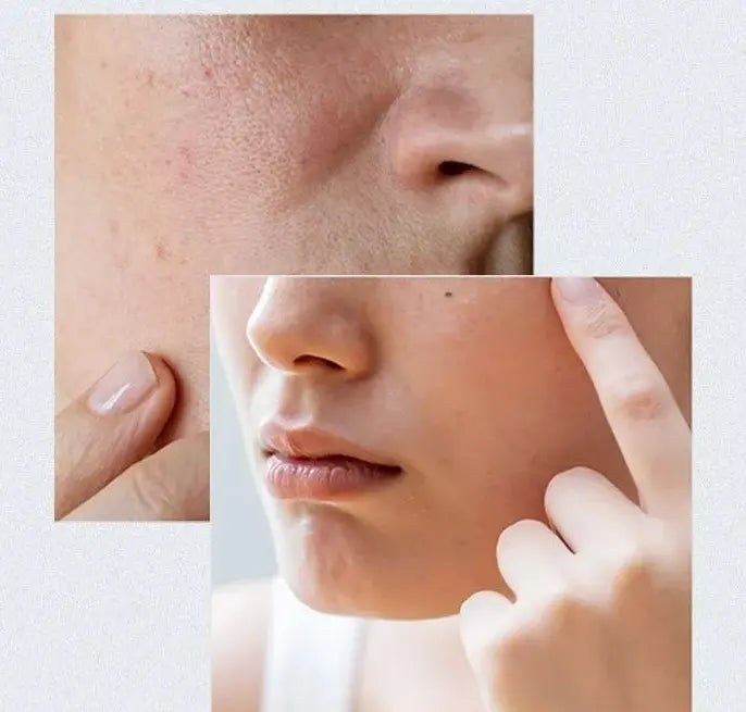 ANUA Birch 70% Moisture Boosting Serum