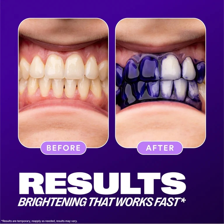 HI SMILE TEETH BRIGHTENING
