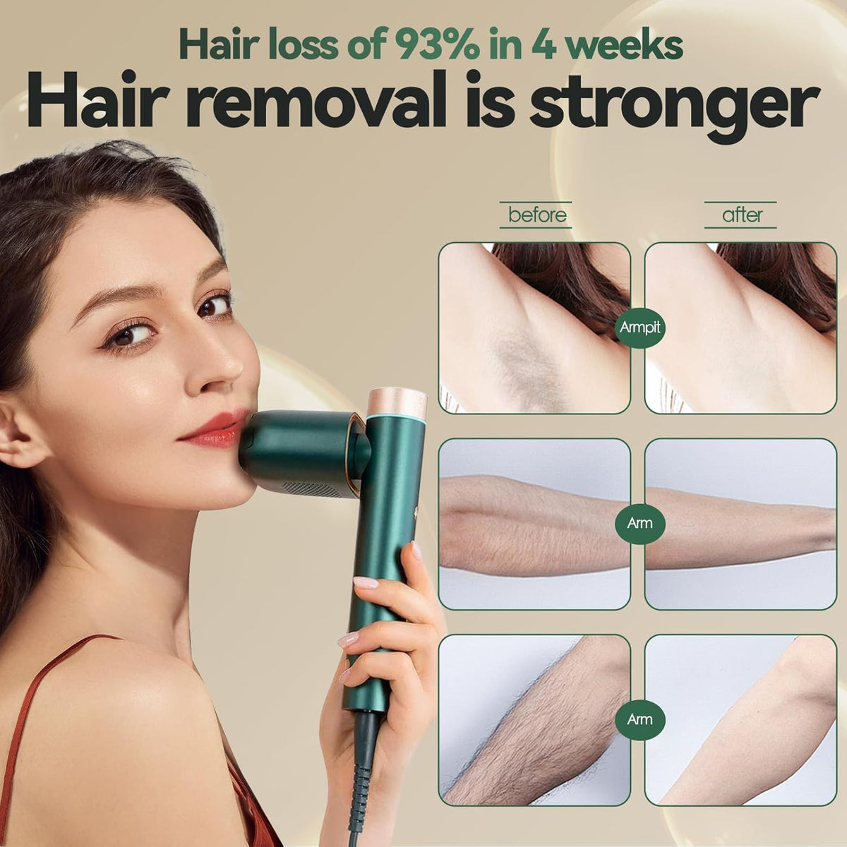VENUS JOVS LASER HAIR REMOVAL
