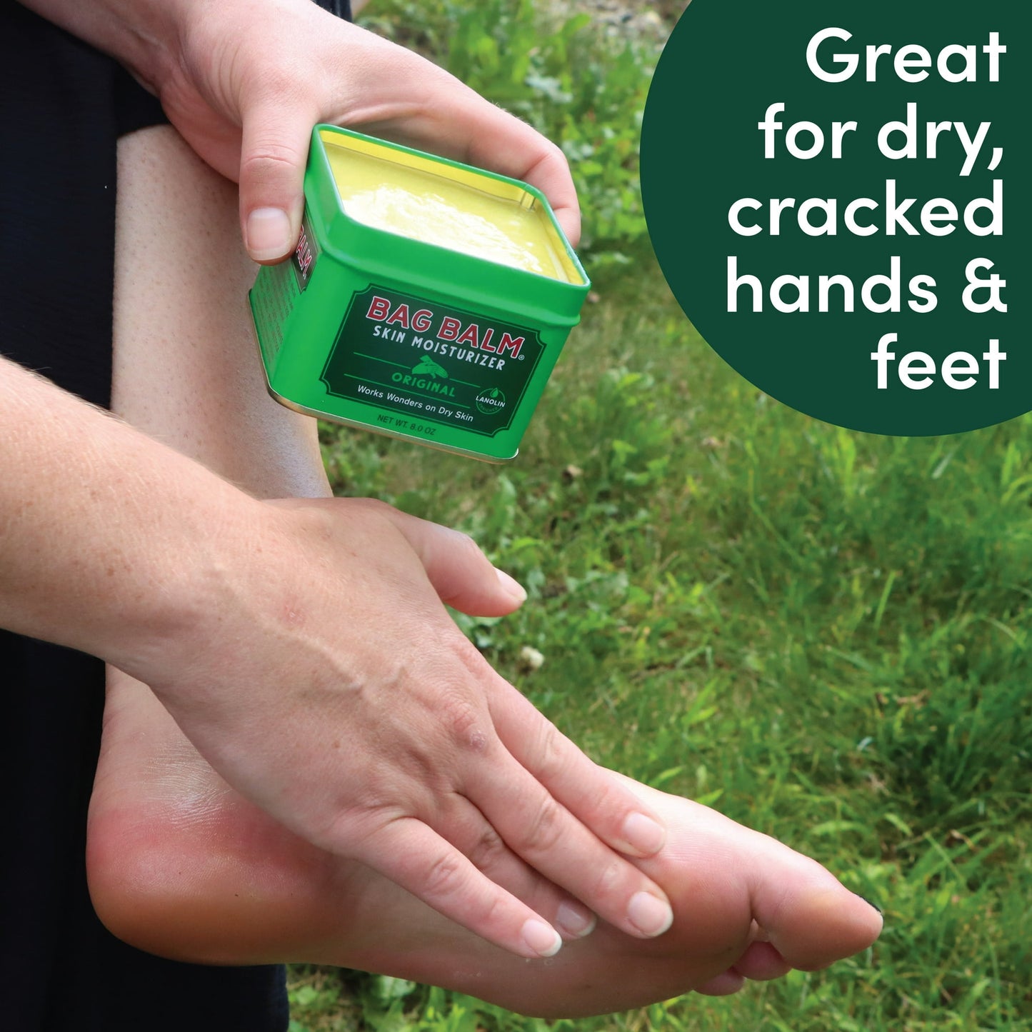 VERMONT’S ORIGINAL BAG BALM, SKIN MOISTURIZER FOR DRY SKIN