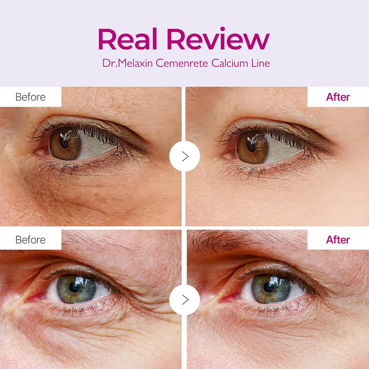 DR.MELAXIN CEMENRETE CALCIUM VOLUME EYE PATCH 60 PIECES