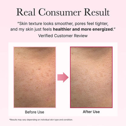 ARENCIA FACE AND EYE MOISTURIZER PDRN BOOSTER SHOT