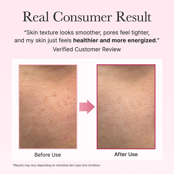 ARENCIA FACE AND EYE MOISTURIZER PDRN BOOSTER SHOT
