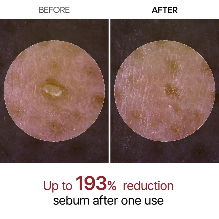 DR.MELAXIN PEEL SHOT EXFOLIATING BLACK RICE AMPOULE (FOR ALL SKIN TYPE)