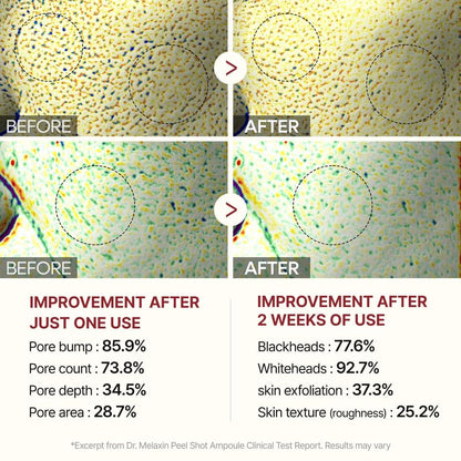 DR.MELAXIN PEEL SHOT EXFOLIATING BLACK RICE AMPOULE (FOR ALL SKIN TYPE)