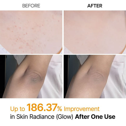 DR.MELAXIN PEEL SHOTEXFOLIATING KOJIC ACID TURMERIC SPRAY