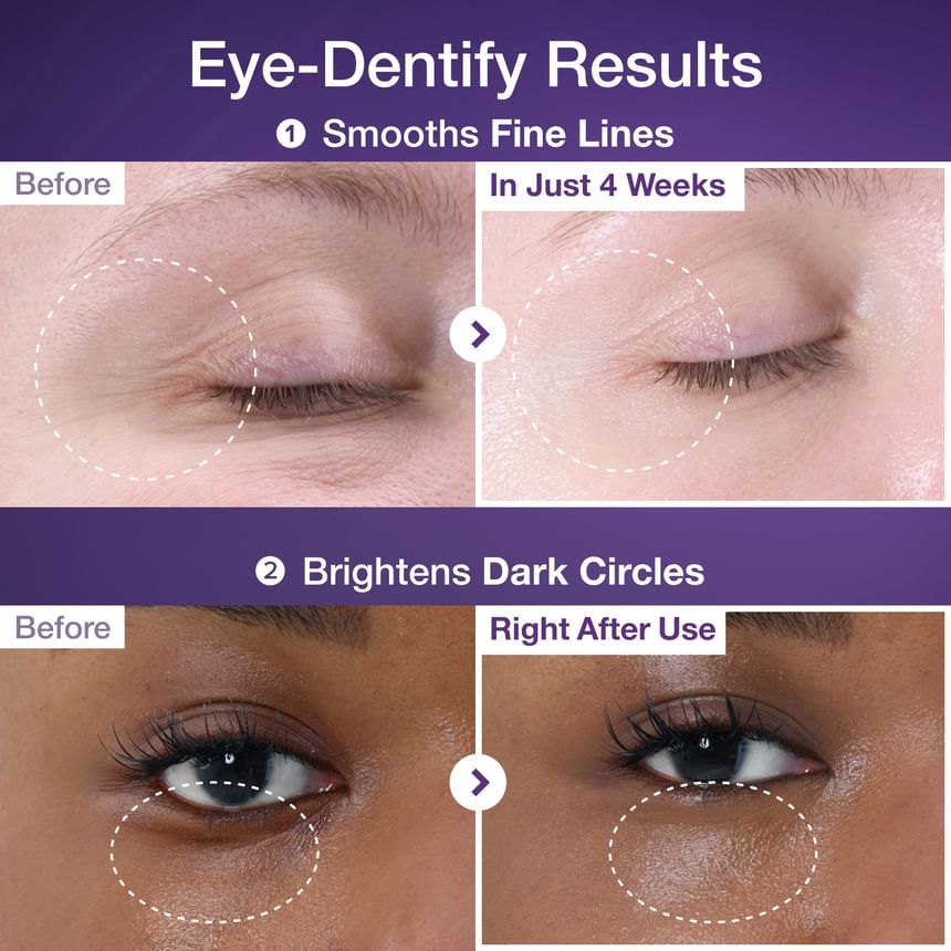 Numbuzin No.9 3 Days Eye Care Kit