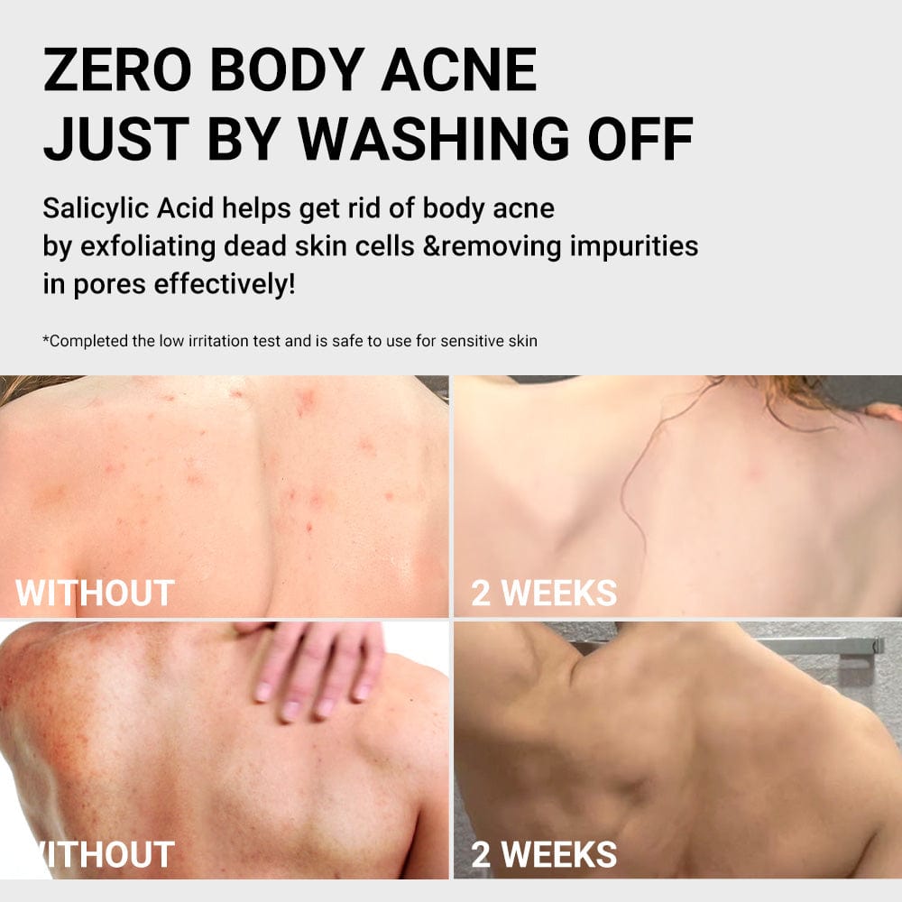 MEDICUBE RED ACNE BODY WASH