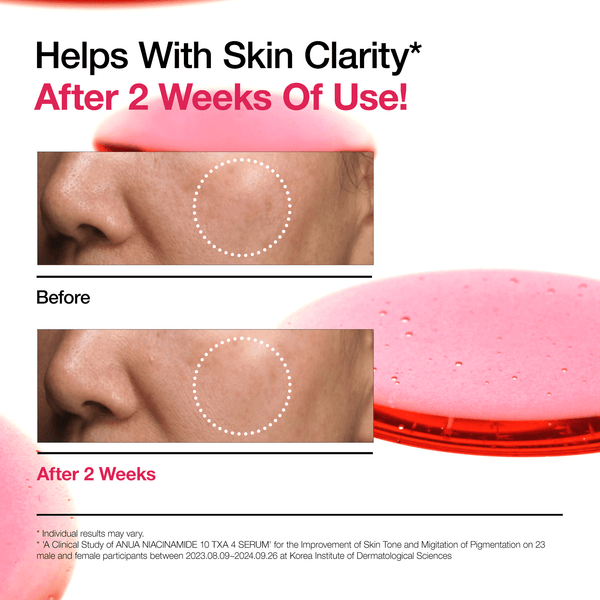 Anua - Niacinamide 10% + Txa 4% Serum
