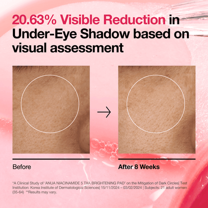ANUA NIACINIMIDE 5 TXA BRIGHTENING PAD(60 PADS)