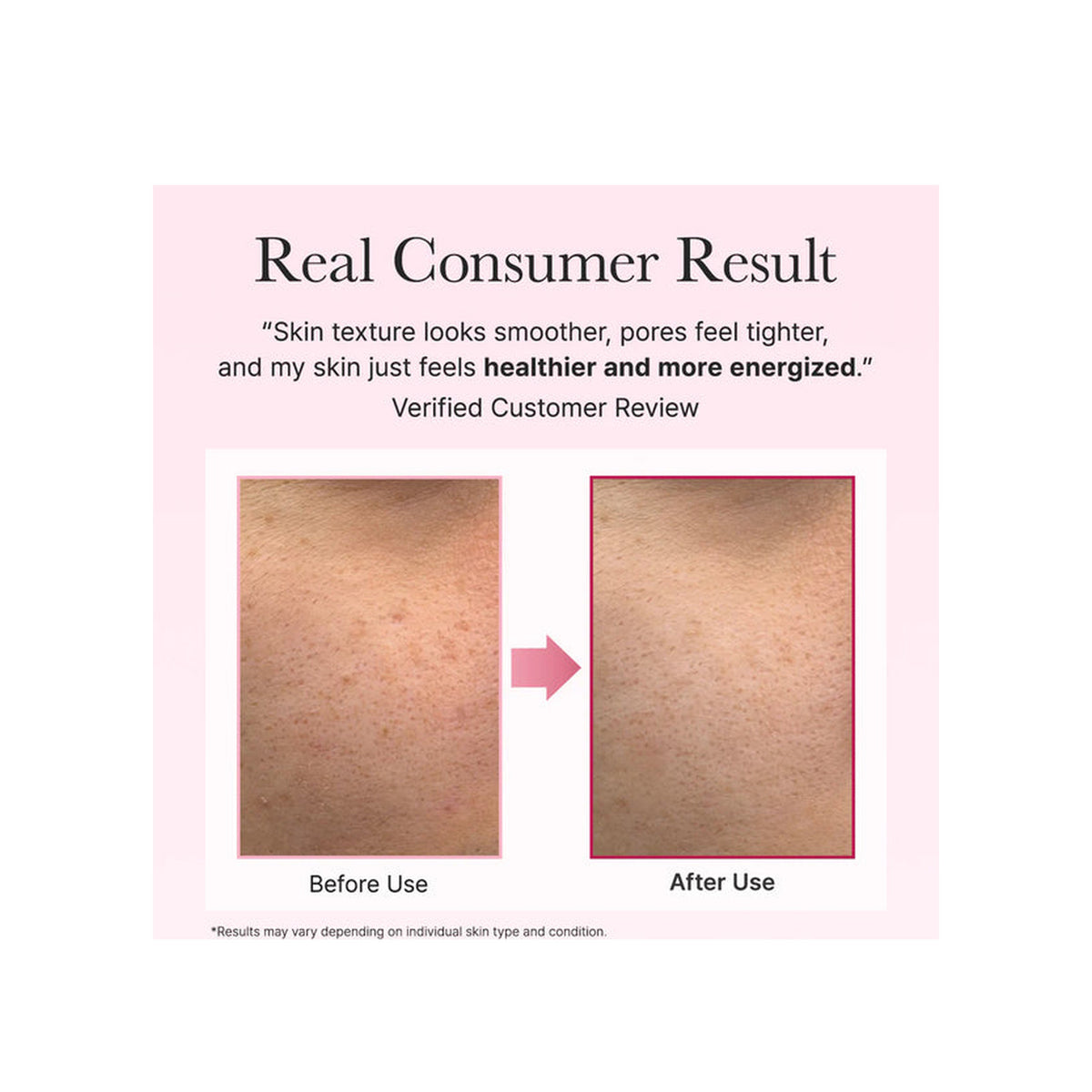 ARENCIA Arencia Face and Eye Moisturizer PDRN Booster Shot — view 3