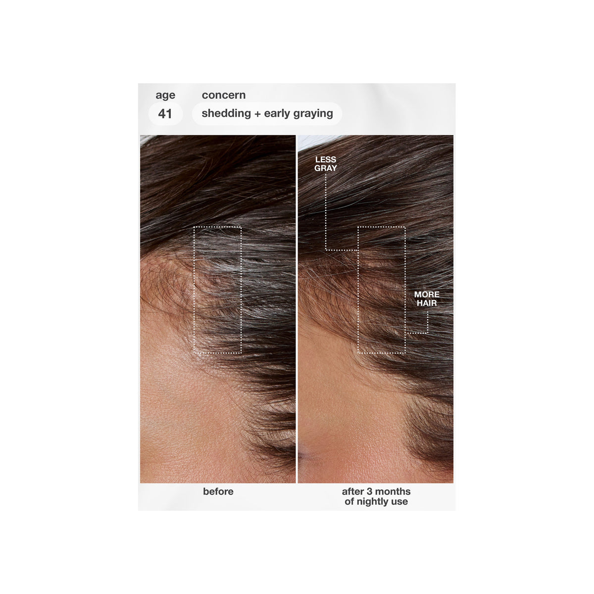 K18 BIOMIMETIC HAIRSCIENCE K18 BIOMIMETIC HAIRSCIENCE FUTUREIQ™ BIOMIMETIC HAIR LONGEVITY SERUM — view 2