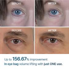 DR.MELAXIN EYEPHALT EYEBAG CREAM