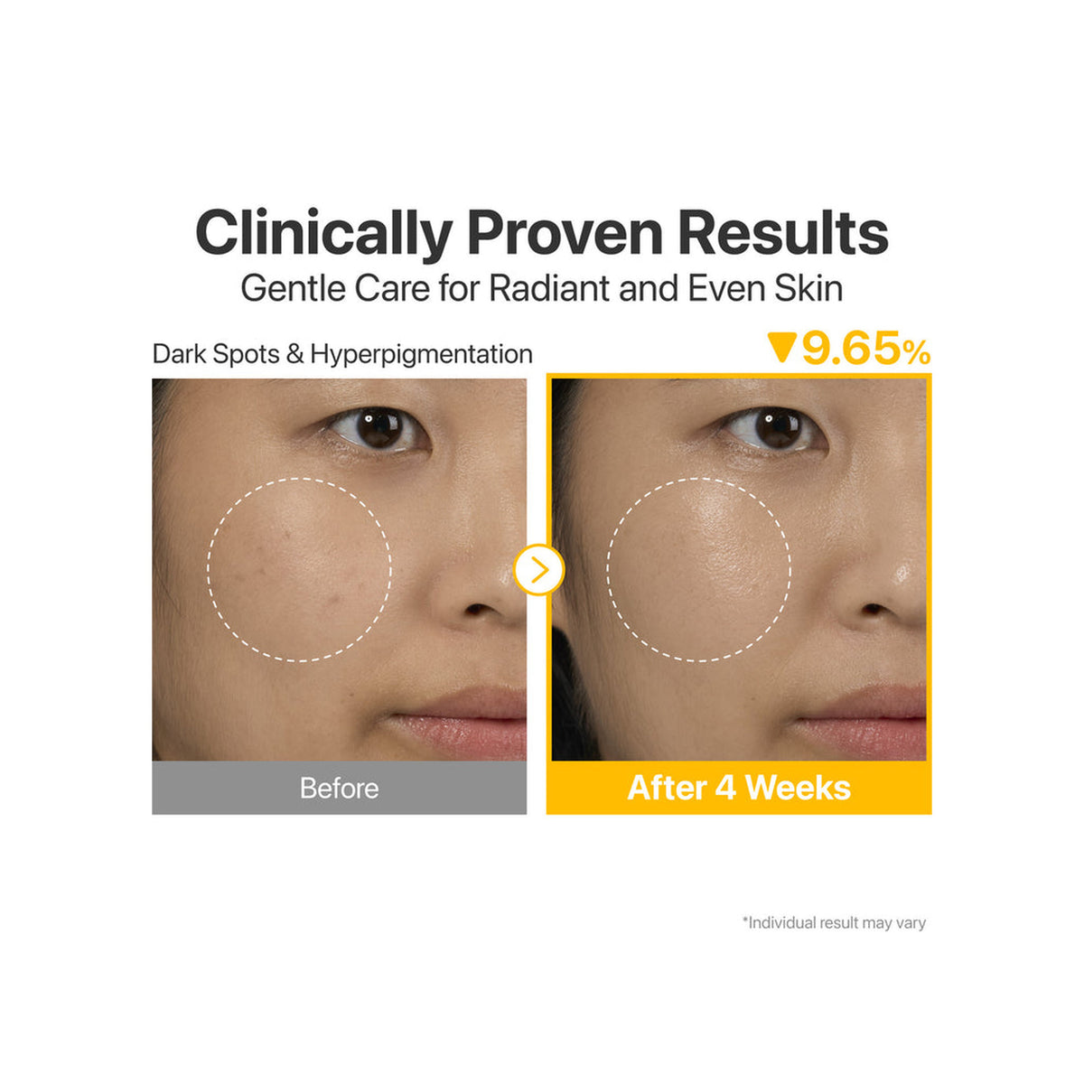 NUMBUZIN Numbuzin No.5+ Glutathione Vitamin Concentrated Serum — view 5