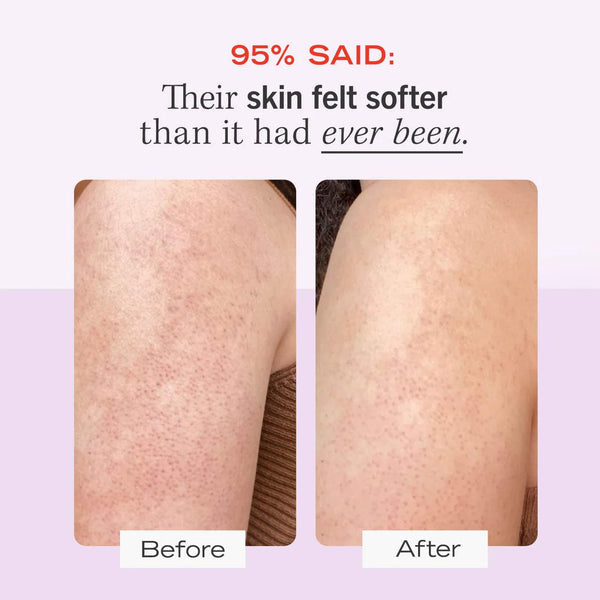FIRST AID BEAUTY BUMP ERASER BODY SCRUB