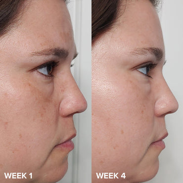 PAULA'S CHOICE EXFOLIATE SKIN PERFECTING 2% BHA LIQUID EXFOLIATE
