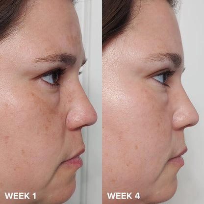 PAULA'S CHOICE EXFOLIATE SKIN PERFECTING 2% BHA LIQUID EXFOLIATE