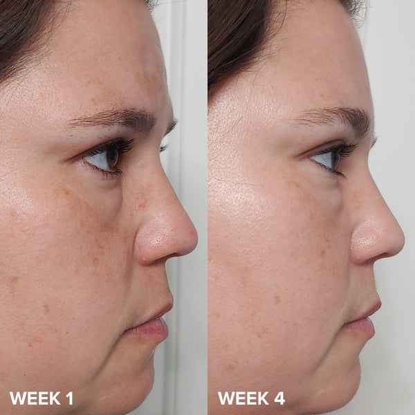 PAULA'S CHOICE EXFOLIATE SKIN PERFECTING 2% BHA LIQUID EXFOLIATE