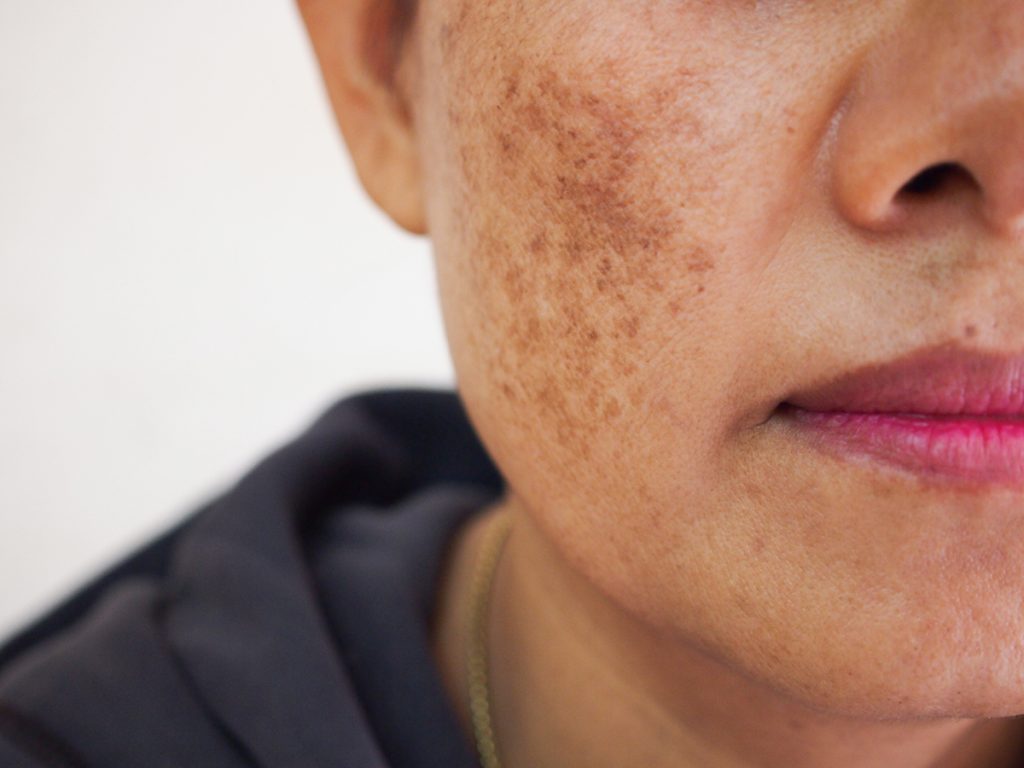 DR.MELAXIN CALCIUM CEMENRETE PICOTONIC SHOT PIGMENTATION CREAM