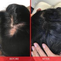 Hairtamin Advanced Formula
